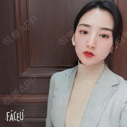 最近拍了几张很有感觉的照片,所以迫不及待的想要来和...眼综合整形悦美整形