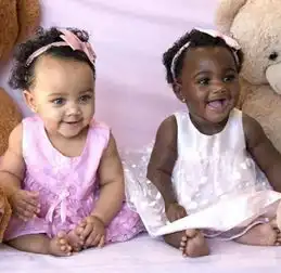  双胞胎肤色一黑一白成网红网友啧啧称奇