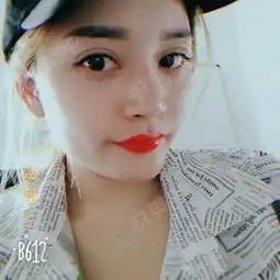 双眼皮已经快两百天咯,是不是很好看了呢闺蜜是现在...双眼皮悦美整形