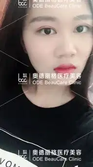  马晓艳重睑内双美女小颖的自拍真人秀