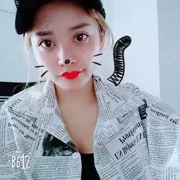 双眼皮已经快两百天咯,是不是很好看了呢闺蜜是现在...双眼皮悦美整形