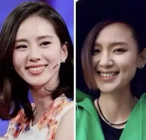 周笔畅承认整容,开始照着闺蜜的样子整,没想到最后整成刘诗诗