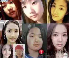  李民浩朴敏英金泰熙韩星整容前后照片大揭秘