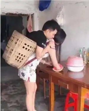  成都连体情侣现状,无腿男另结新欢,断臂女独自带娃