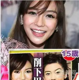  整容情侣李敏镐黄晓明baby深陷假脸风波