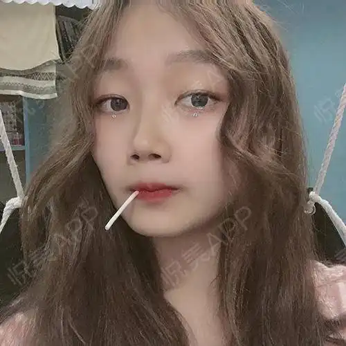 嗨喽嗨喽小美女们来更新啦,迫不及待来反馈热玛吉的皮...紧致提升悦美整形