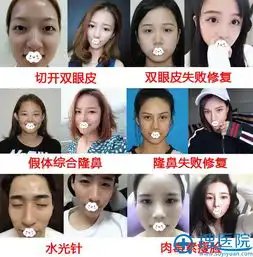 陪闺蜜到深圳蒳美迩做整形顺便看了案例对比与专家实力