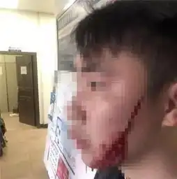  突发桂林北站一对年轻情侣正拥抱告别,女方突然掏出刀片划伤男友双脸