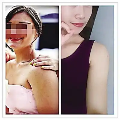 朋友圈擅自发原图重庆女孩气得直接把闺蜜拉黑了