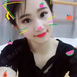迫不及待的再来跟大家看看眼睛现在的情况,感觉就是越...眼综合悦美整形